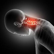 Gimdos kaklelio osteochondrozė